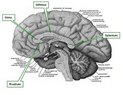 Median section of the brain