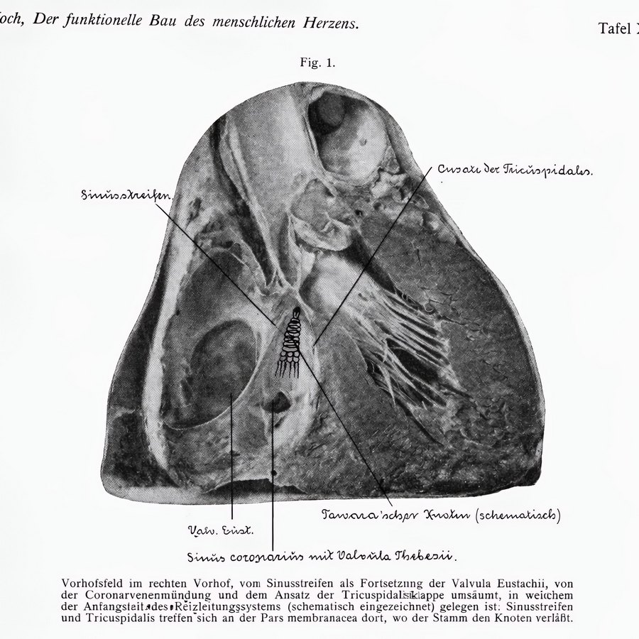 1922 original image by Koch showing the area for the AV node 1922 original image by Koch showing the area for the AV node
