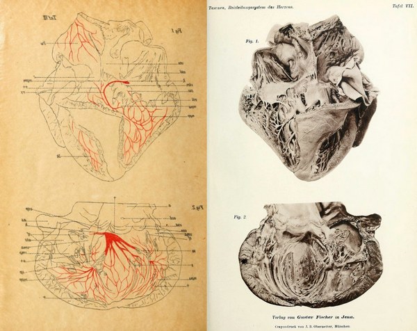 Image from Sunao Tawara MD monograph on the conduction system of the heart Image from Sunao Tawara MD monograph on the conduction system of the heart