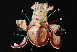 Heart model - LAO cranial view