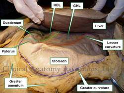 Anteroinferior view of the liver and stomach. HDL= Hepatoduodenal ligament GDL= Gastroduodenal ligament