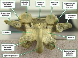 Posterior view of a lumbar vertebra